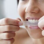 From Teeth-Whitening Gel to Whitening Strips 5 Ways to Flaunt Those Pearly Whites