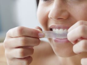 From Teeth-Whitening Gel to Whitening Strips 5 Ways to Flaunt Those Pearly Whites