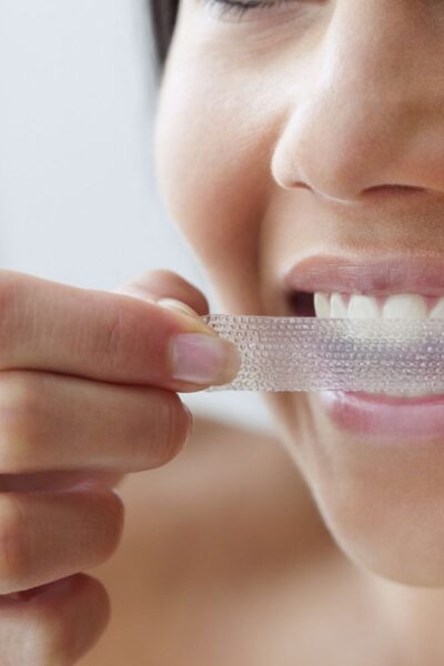 From Teeth-Whitening Gel to Whitening Strips 5 Ways to Flaunt Those Pearly Whites